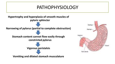 Hypertrophic Pyloric Stenosis Ppt