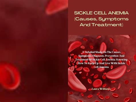 Amazon Co Jp Sickle Cell Anemia Causes Symptoms And Treatment A