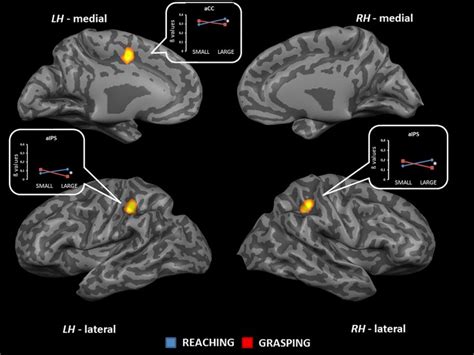 Brain Regions Showing Significant Interaction Effects Between Type Of