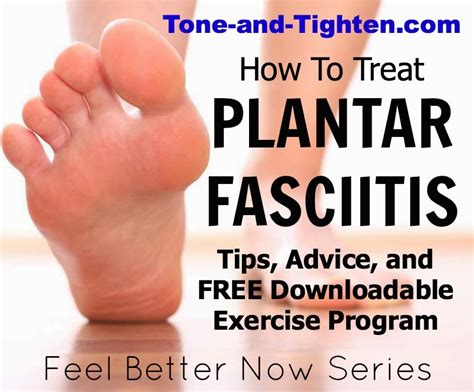 How To Treat Plantar Fasciitis Best Exercises Free Downloadable