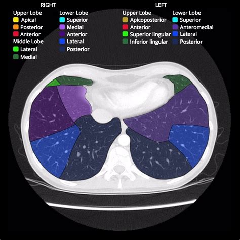 Lung Segments