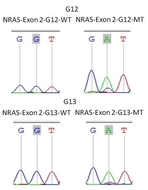 Nras Exon Primer Set Femtopath Hongjing