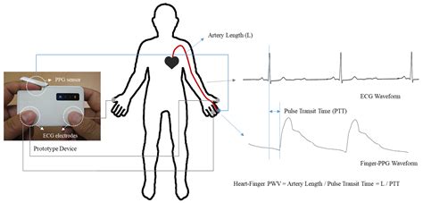 Sensors Free Full Text A Comparative Study Of Brachialankle Pulse