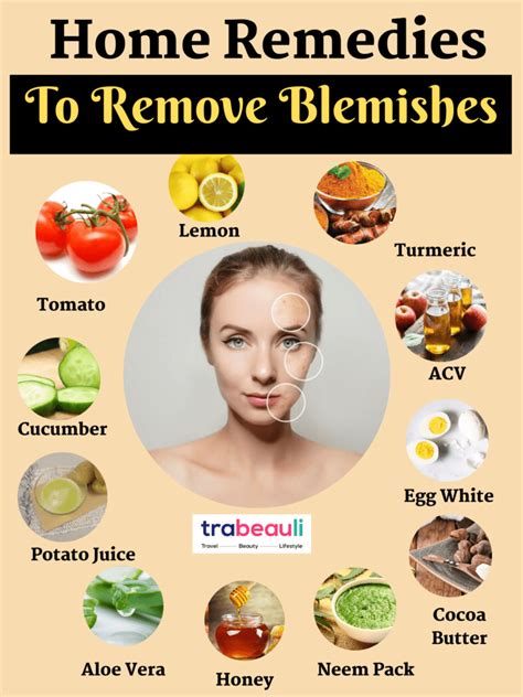 How To Get Rid Of Blemishes At Home Home Remedies Beauty And