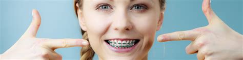 Benefits Of Clear Braces For Adults