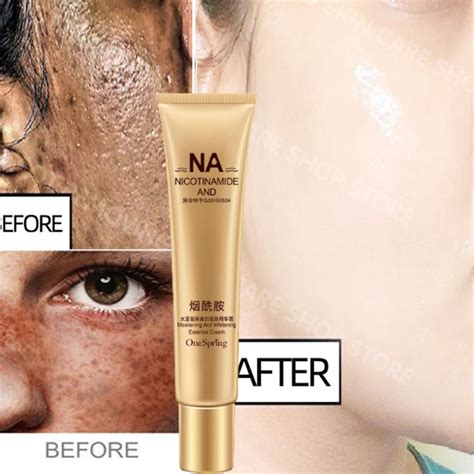 Original Whitening Melasma Cream Nicotinamide Whitening Freckle Cream