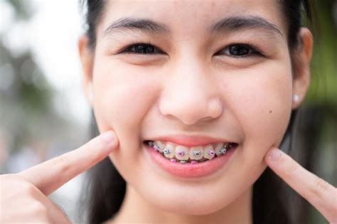 Premium Photo Portrait Of A Young Asian Woman With Braces On Her Teeth