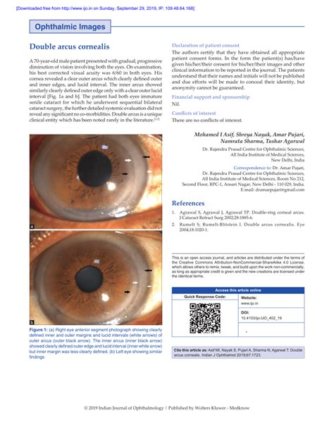 PDF Double Arcus Cornealis