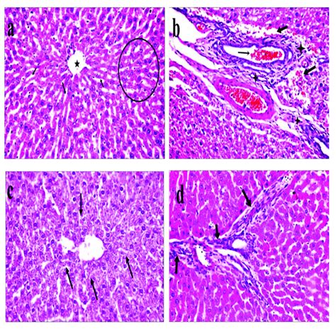 Representative Photomicrographs Of Rat Livers A Group 1 Negative Download Scientific