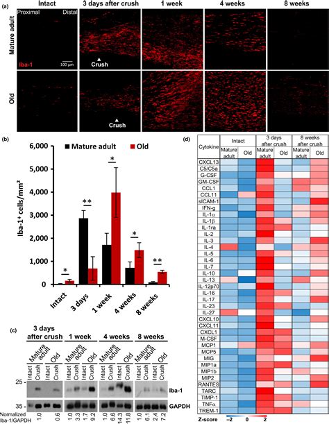 Inflammaging Impairs Peripheral Nerve Maintenance And Regeneration