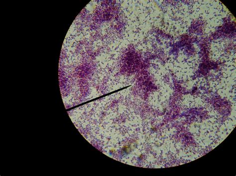 Bio E Journal Acid Fast Endospore Staining