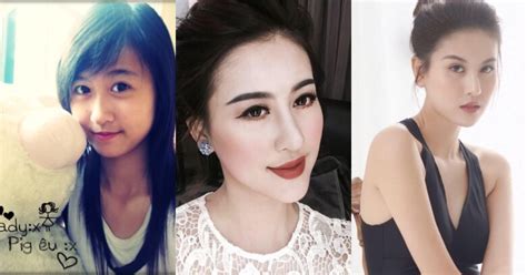 Dàn hot girl gần như thay mặt vì dao kéo Bạn thân Huyền Baby suýt hoại tử cằm Ngân 98 mặt