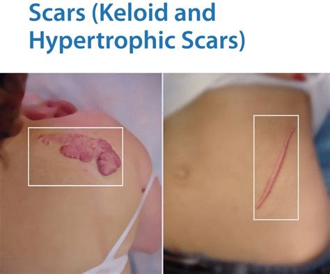 Scars Rederm Medical Center