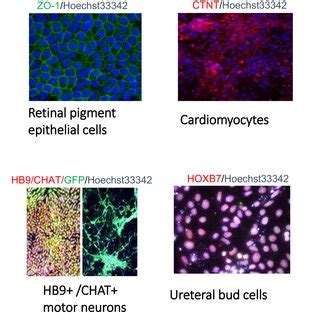 Images Of NSCRC HESCderived Functional Cell Lines In The