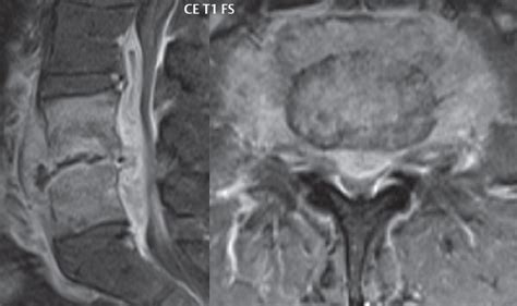 Infection And Inflammation Radiology Key