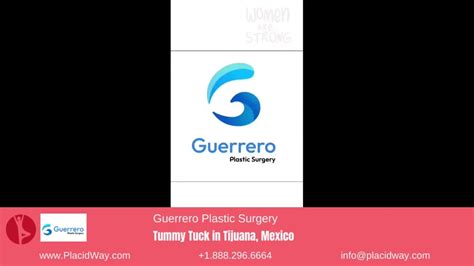 Tummy Tuck In Tijuana Mexico By Guerrero Plastic Surgery Patient