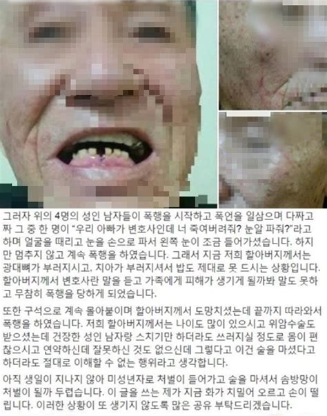 70대 경비원 때린 10대 아빠가 변호사라더니술 취해 기억안나 발뺌 한국경제