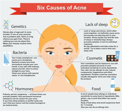 6 Causes of Acne | Acne causes, How to treat acne, Skin care advices