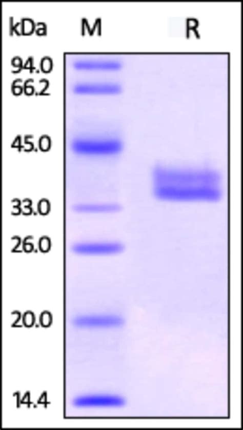 Acrobiosystems Biotinylated Human Gpa Protein His Tag Ultra