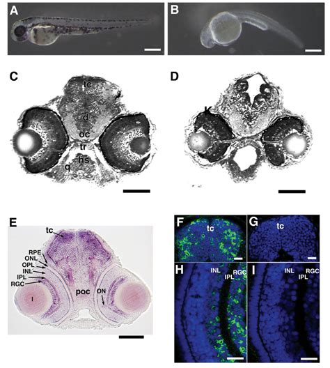 Effect Of Olfm Downregulation On The Development Of Zebrafish Embryos