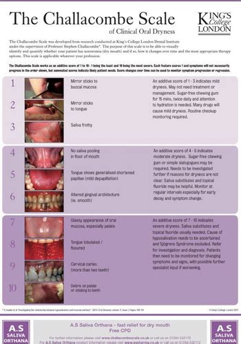 Xerostomia Flashcards Quizlet