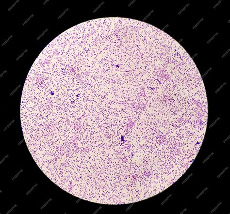 Premium Photo Staphylococcus Aureus Bacteria Colonie Gram Stain