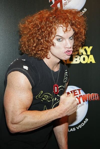 Topsi News: Carrot Top Plastic Surgery