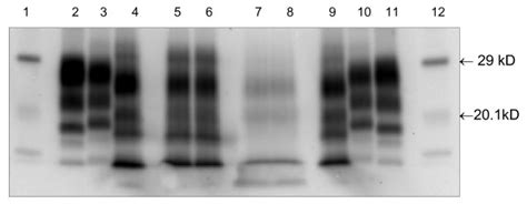 Bio Rad Western Blot Wb Showing Samples From G320 Frontal Cortex