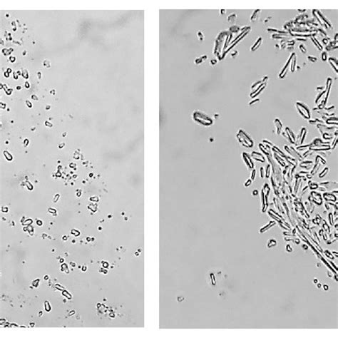 Microscopic images of tragacanth samples (right: AC tragacanth ...