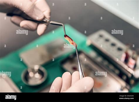 Platelet Rich Fibrin Stock Photo Alamy