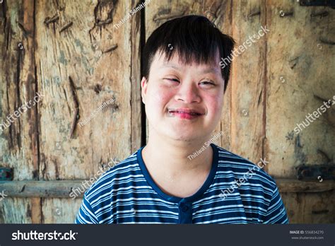 Portrait Down Syndrome Boy Smile Camera Stock Photo Edit Now 556834270