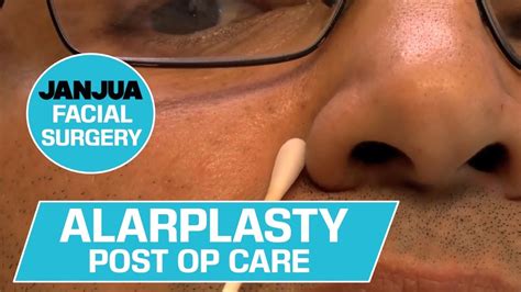 Alarplasty Post Op Care Dr Tanveer Janjua New Jersey Youtube