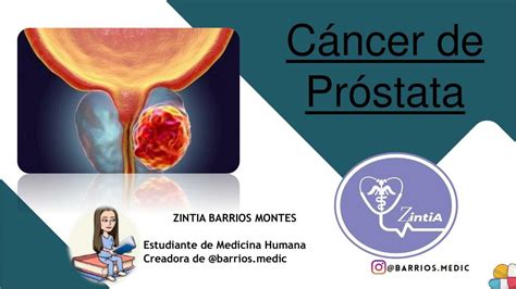 Cáncer De Próstata Barrios Medic 👩‍⚕️📚 Udocz