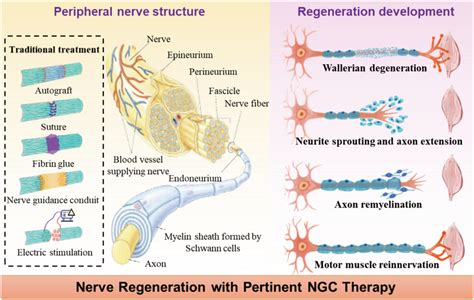 Need To Design The Guidance Conduit Pertinently In The Nerve