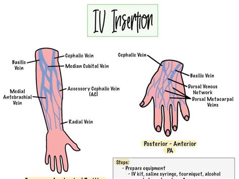 Iv Insertion Cheat Sheet Etsy Nursing School Studying Cheat Sheets