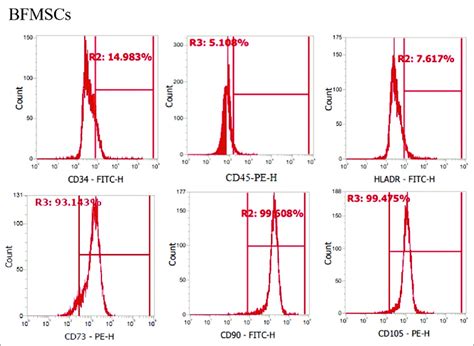 Immunophenotypic Expression Of Cluster Of Differentiation CD By Flow