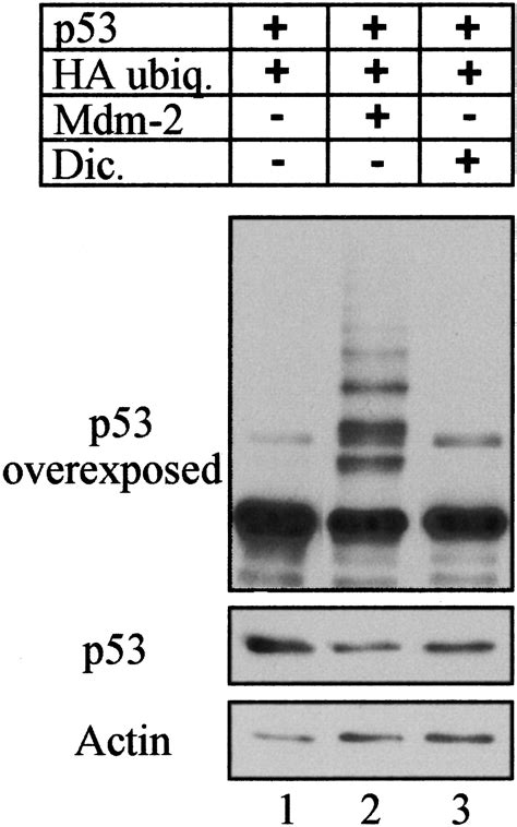 Mdm 2 And Ubiquitin Independent P53 Proteasomal Degradation Regulated