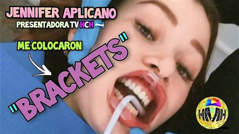 JENNIFER APLICANO ME COLOCARON BRACKETS PRESENTADORA TV HCH YouTube