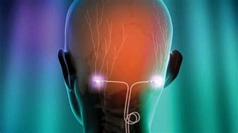 Occipital Nerve Stimulation Implant, a Community Crowdfunding Project ...