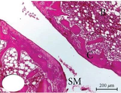 Photomicrographs X Of He Stained Sections Showing The Effect Of