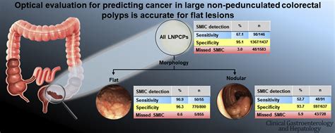 Optical Evaluation For Predicting Cancer In Large Nonpedunculated