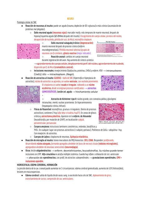 Resumen Del Libro Anatomia Patologica Robbins Capitulo Iovanny Cruz