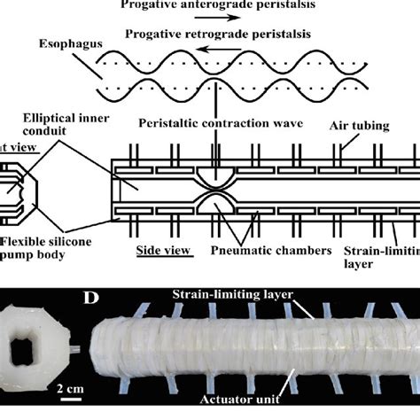 Time-lapse images of the peristaltic cycle with forced contraction ...