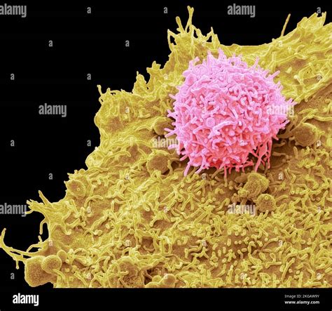 Car T Cell Therapy Coloured Scanning Electron Micrograph Sem Of A T