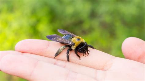 Severe Bee Sting Swelling