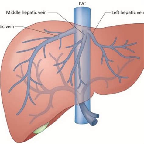 Hepatic Venous Vasculature Right Middle And Left Hepatic Veins Drain