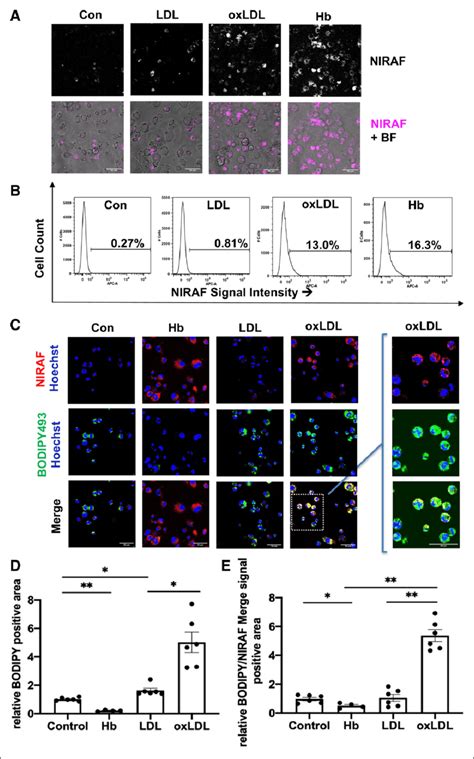 OxLDL Oxidized Low Density Lipoprotein Driven Near Infrared