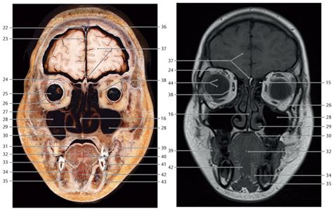 Diagram Of Coronal Section Through Head At Level Of Second Premolar Of