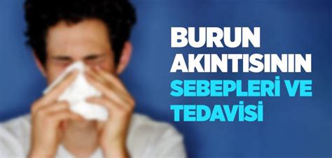 Burun Akıntısının Nedenleri Ve Tedavisi İslam Ve İhsan