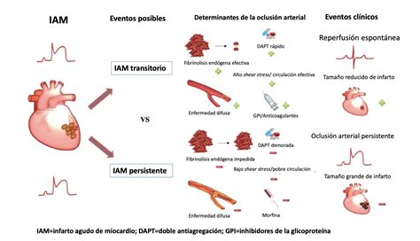 Reperfusión Espontánea En Pacientes Con Infarto Agudo De Miocardio Y